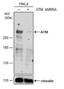 ATM Antibody