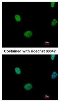 ATM Antibody in Immunocytochemistry (ICC/IF)