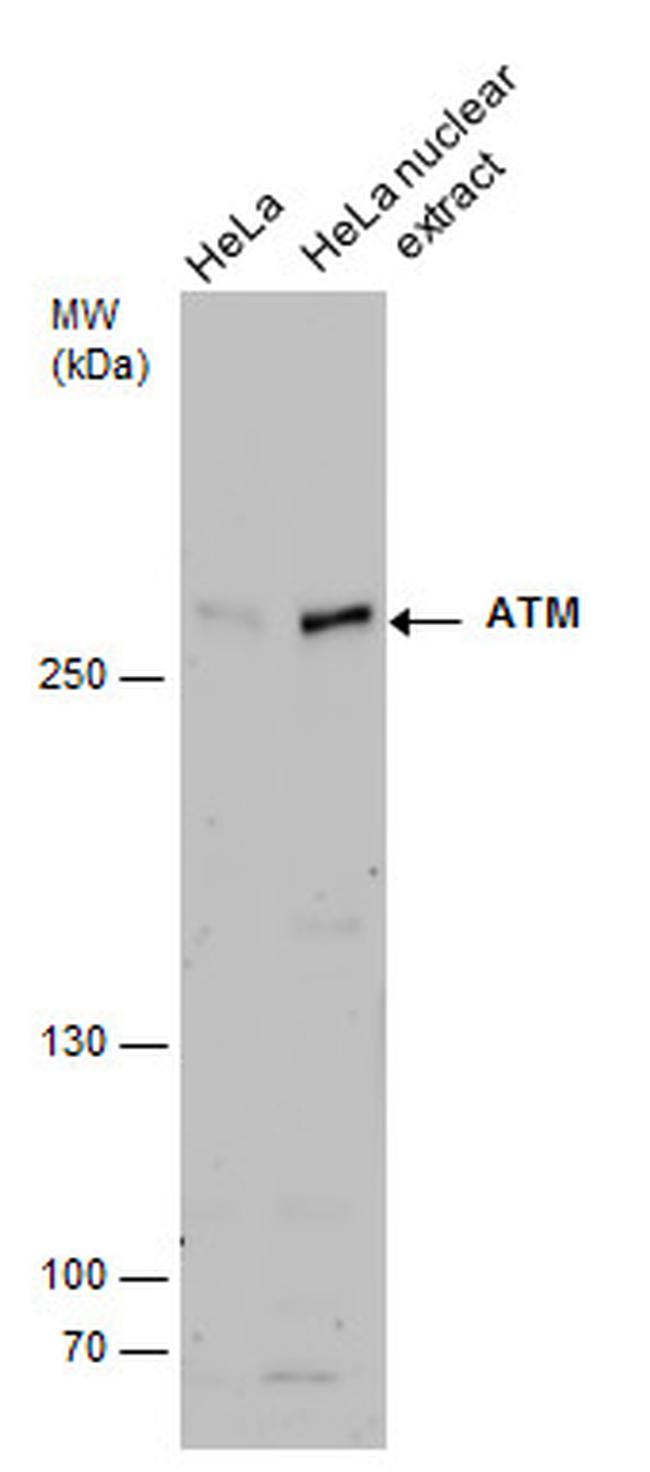 ATM Antibody in Western Blot (WB)