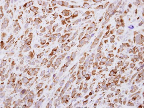 EGF Antibody in Immunohistochemistry (Paraffin) (IHC (P))