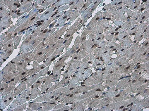 FZR1 Antibody in Immunohistochemistry (Paraffin) (IHC (P))