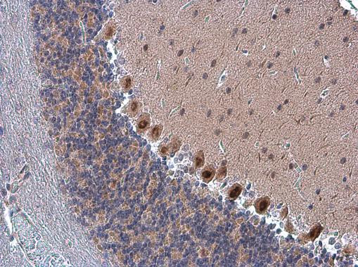 FZR1 Antibody in Immunohistochemistry (Paraffin) (IHC (P))