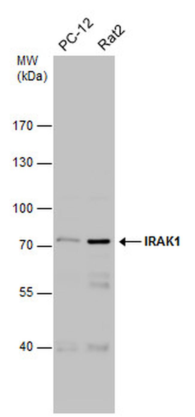 IRAK1 Antibody in Western Blot (WB)