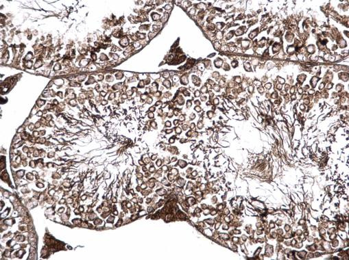 PSKH1 Antibody in Immunohistochemistry (Paraffin) (IHC (P))