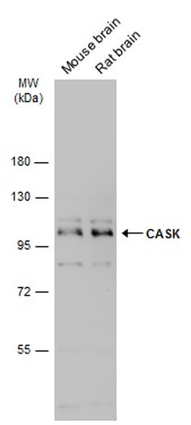 CASK Antibody in Western Blot (WB)