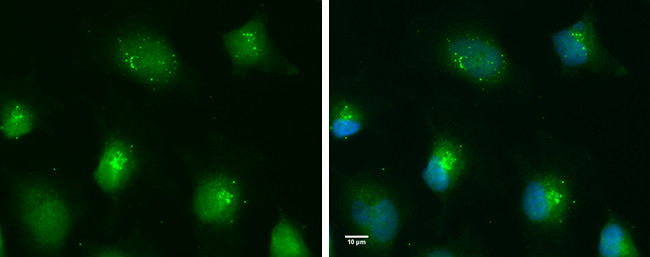 TLR9 Antibody in Immunocytochemistry (ICC/IF)