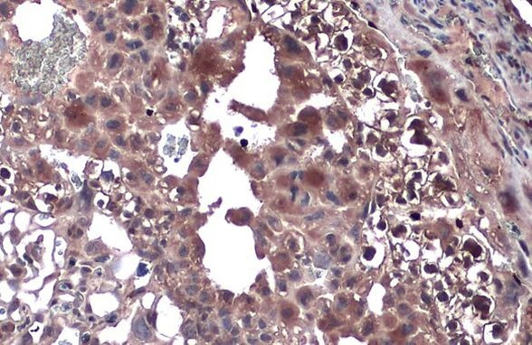 TLR9 Antibody in Immunohistochemistry (Paraffin) (IHC (P))