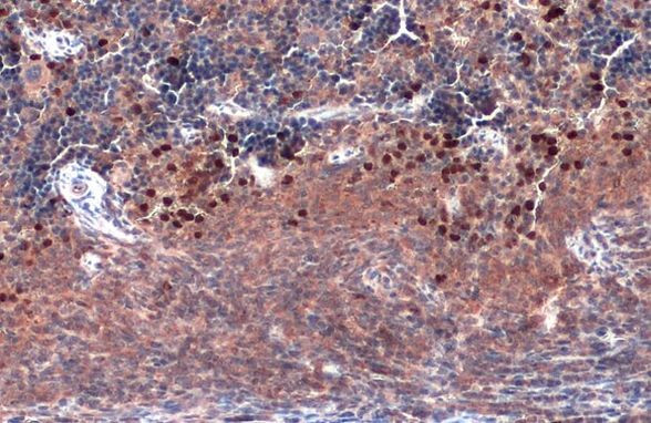 TLR9 Antibody in Immunohistochemistry (Paraffin) (IHC (P))