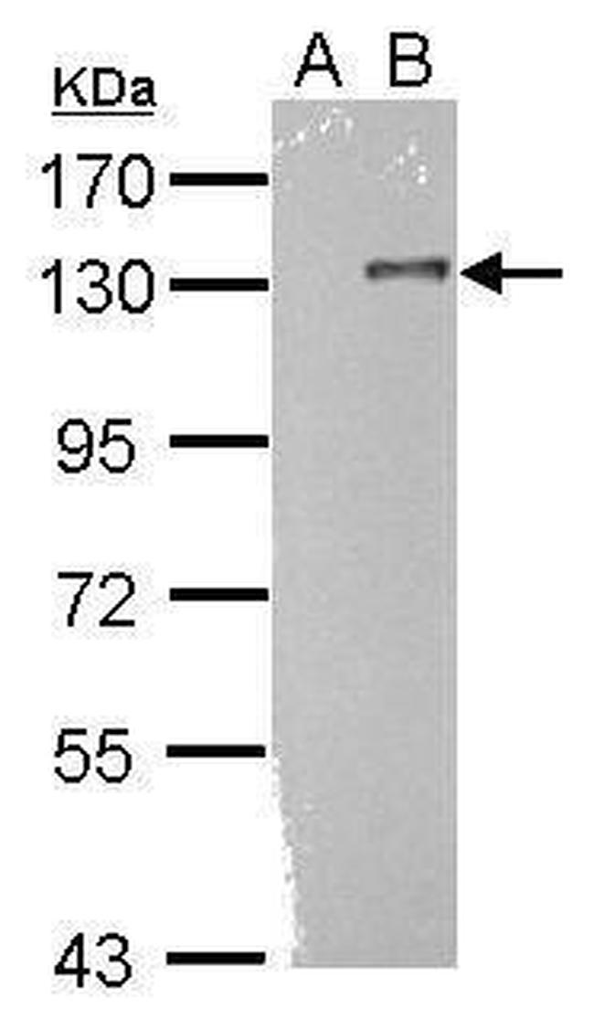 TLR9 Antibody in Western Blot (WB)