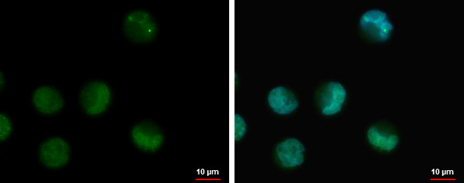 IRAK-M Antibody in Immunocytochemistry (ICC/IF)