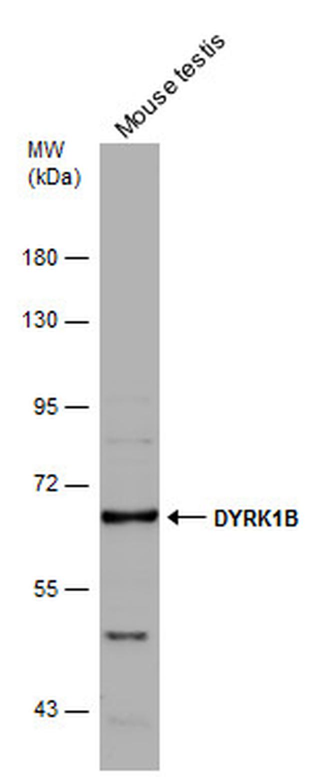 DYRK1B Antibody in Western Blot (WB)