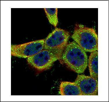 Lyn Antibody in Immunocytochemistry (ICC/IF)