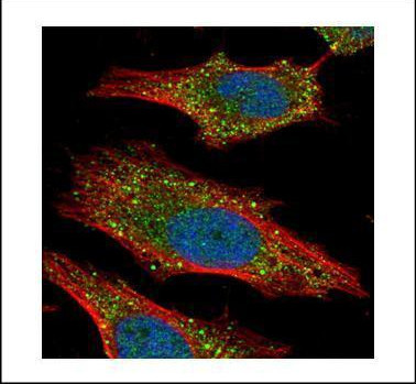 AKT2 Antibody in Immunocytochemistry (ICC/IF)