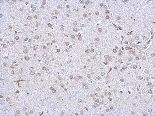 Lamin A/C Antibody in Immunohistochemistry (Paraffin) (IHC (P))