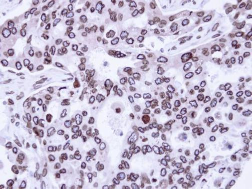 Lamin A/C Antibody in Immunohistochemistry (Paraffin) (IHC (P))