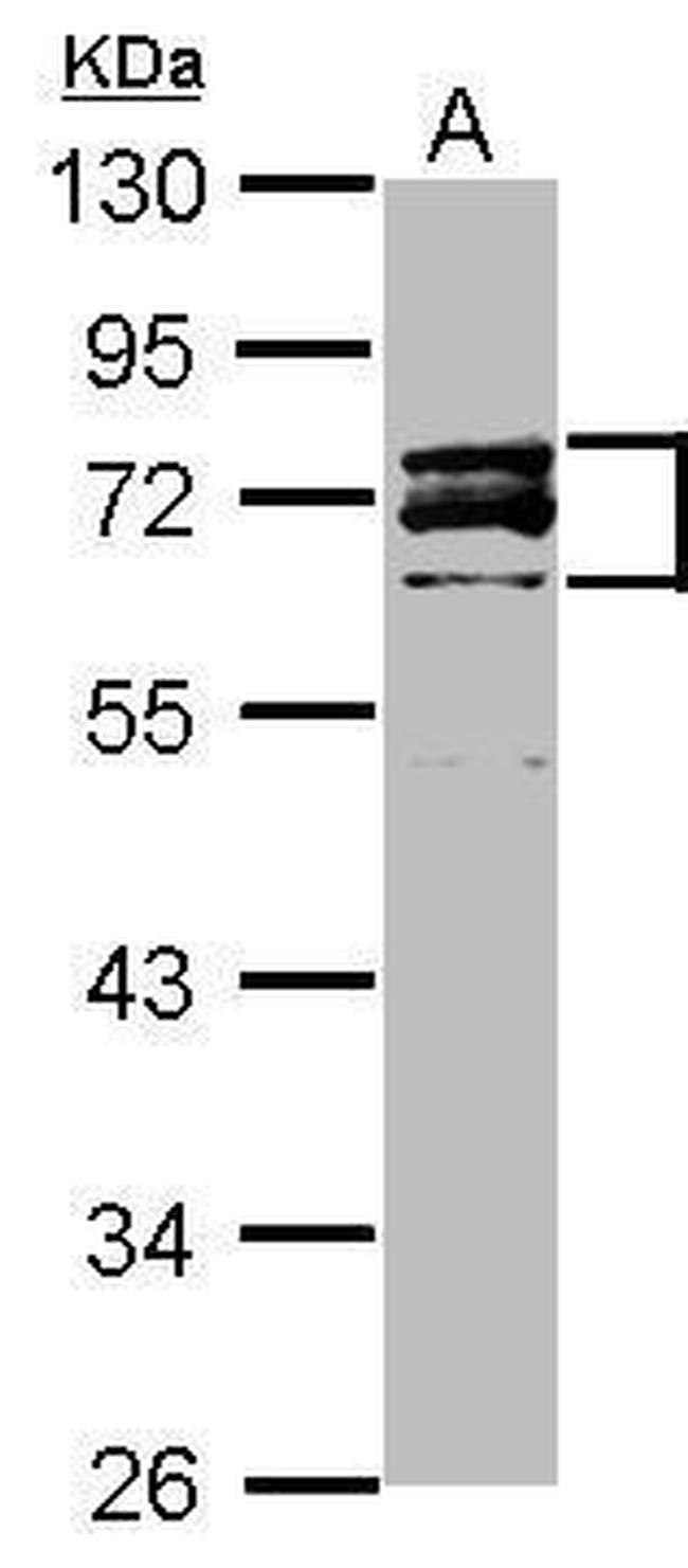 Lamin A/C Antibody in Western Blot (WB)