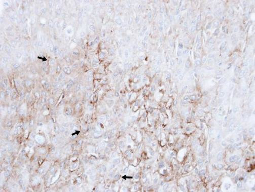 LAMP2 Antibody in Immunohistochemistry (Paraffin) (IHC (P))