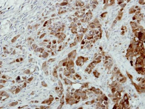 PRDX3 Antibody in Immunohistochemistry (Paraffin) (IHC (P))