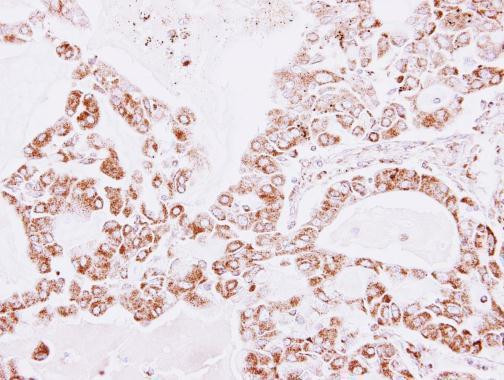 PRDX3 Antibody in Immunohistochemistry (Paraffin) (IHC (P))