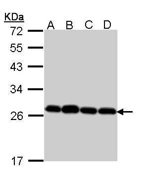 PRDX3 Antibody in Western Blot (WB)