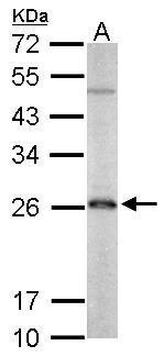 PRDX3 Antibody in Western Blot (WB)