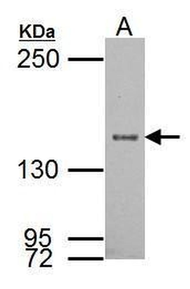 SRC1 Antibody in Western Blot (WB)