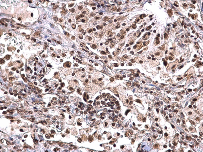 NPM1 Antibody in Immunohistochemistry (Paraffin) (IHC (P))