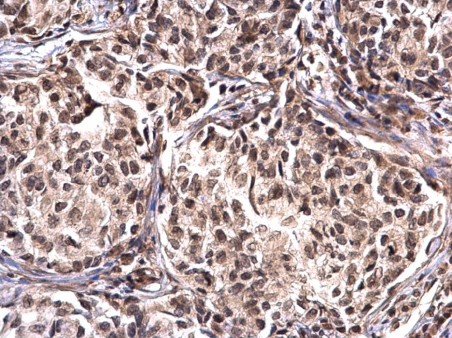 NPM1 Antibody in Immunohistochemistry (Paraffin) (IHC (P))