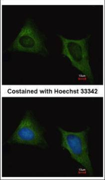 beta Tubulin Antibody in Immunocytochemistry (ICC/IF)