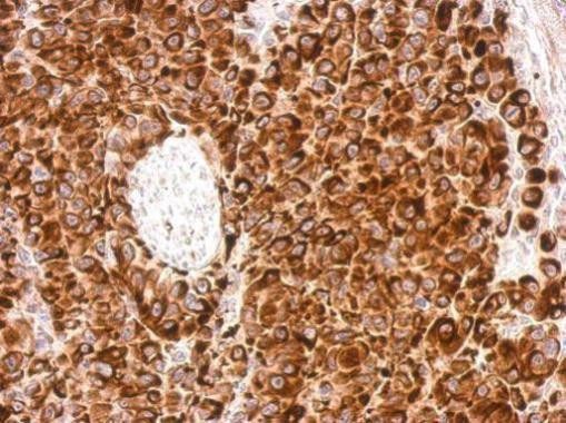 Vimentin Antibody in Immunohistochemistry (Paraffin) (IHC (P))