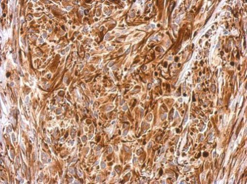 Vimentin Antibody in Immunohistochemistry (Paraffin) (IHC (P))