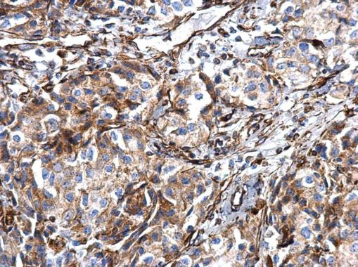 Vimentin Antibody in Immunohistochemistry (Paraffin) (IHC (P))