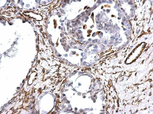 Vimentin Antibody in Immunohistochemistry (Paraffin) (IHC (P))