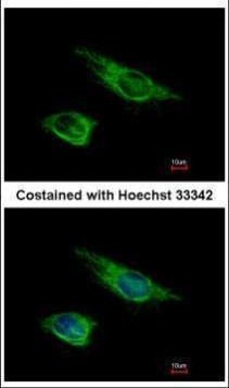 Vimentin Antibody in Immunocytochemistry (ICC/IF)