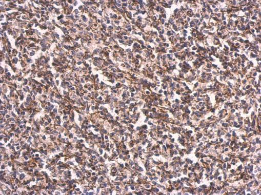 Vimentin Antibody in Immunohistochemistry (Paraffin) (IHC (P))