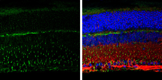 Vimentin Antibody in Immunohistochemistry (Paraffin) (IHC (P))