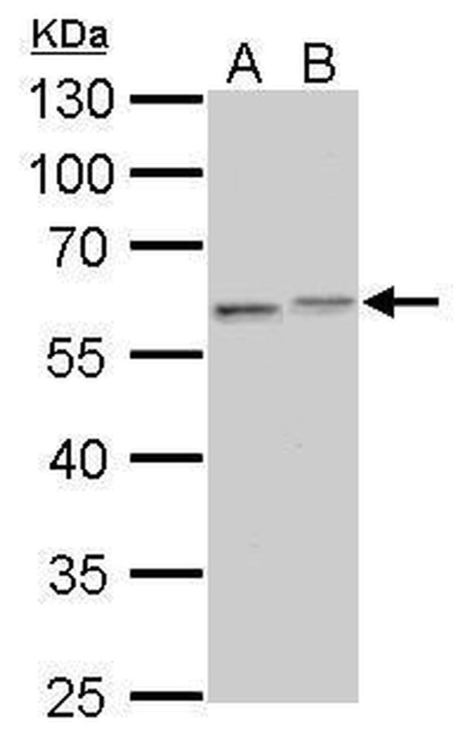 Vimentin Antibody in Western Blot (WB)