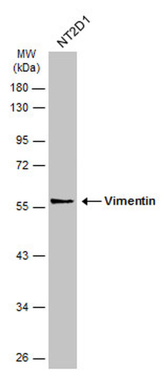 Vimentin Antibody in Western Blot (WB)