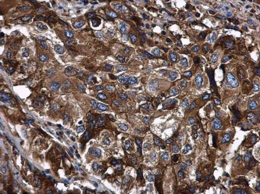 alpha-1 Antitrypsin Antibody in Immunohistochemistry (Paraffin) (IHC (P))