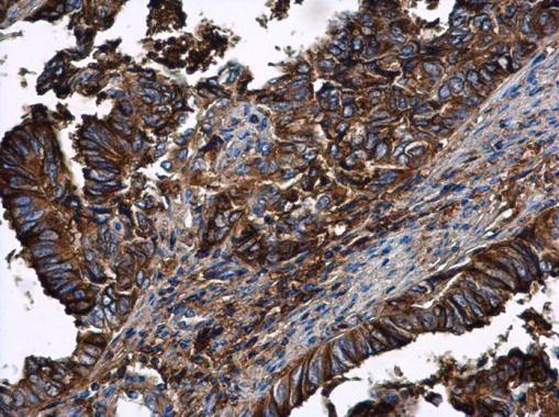 alpha-1 Antitrypsin Antibody in Immunohistochemistry (Paraffin) (IHC (P))