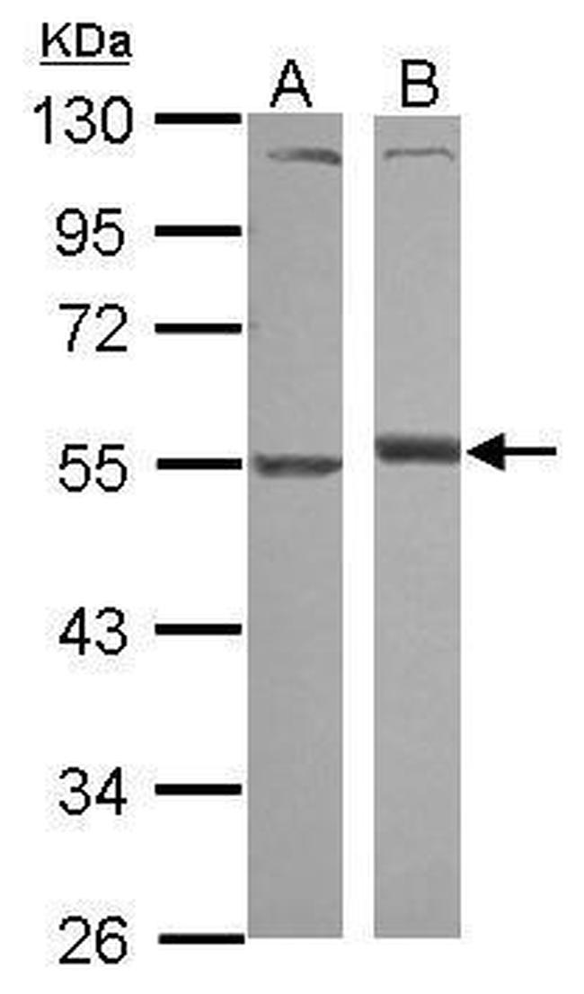 alpha-1 Antitrypsin Antibody in Western Blot (WB)