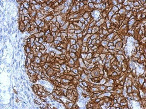 HLA-G Antibody in Immunohistochemistry (Paraffin) (IHC (P))