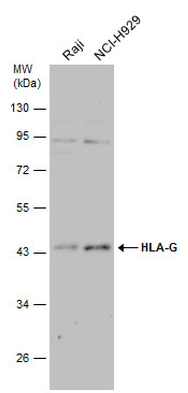 HLA-G Antibody in Western Blot (WB)