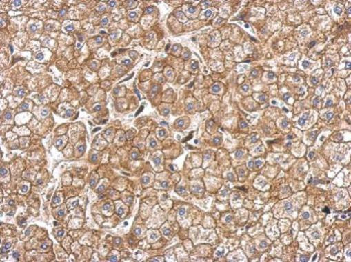 N-cadherin Antibody in Immunohistochemistry (Paraffin) (IHC (P))