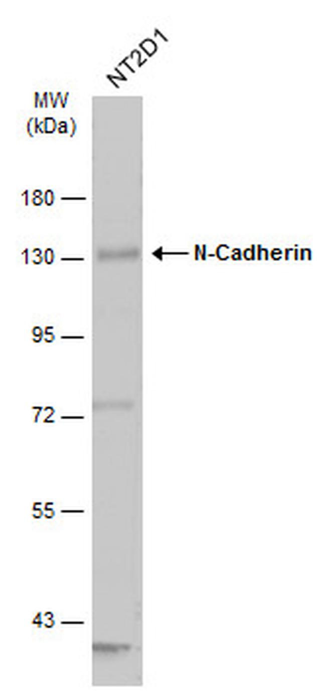 N-cadherin Antibody in Western Blot (WB)