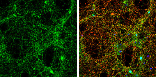 alpha Synuclein Antibody in Immunocytochemistry (ICC/IF)