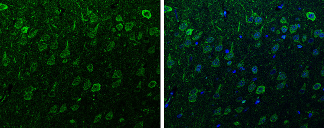 alpha Synuclein Antibody in Immunohistochemistry (Paraffin) (IHC (P))