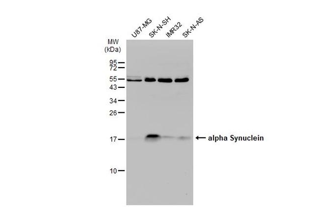 alpha Synuclein Antibody in Western Blot (WB)