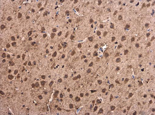 alpha Synuclein Antibody in Immunohistochemistry (Paraffin) (IHC (P))