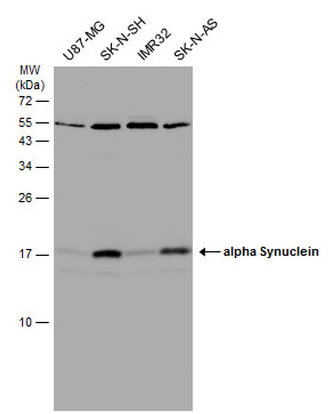 alpha Synuclein Antibody in Western Blot (WB)